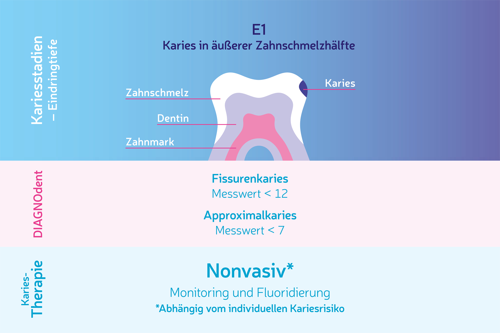 Zahnarztpraxis Cambradent - Karies in äußerer Zahnschmelzhälfte